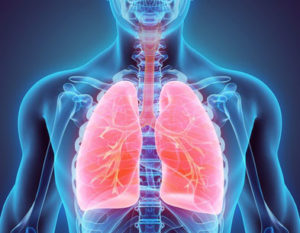 pulmonary disorder image